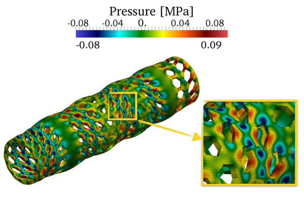 Figure 1. Simulation of a vascular stent under dynamic torsion loading (incompressible rubber constitutive law).